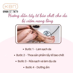 bi-viem-nang-long-co-nen-tay-te-bao-chet