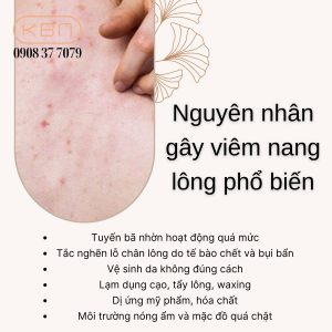 cach-tri-viem-nang-long-bang-nha-dam
