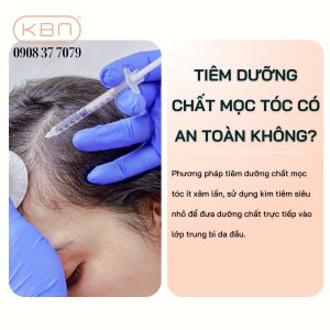 lieu-phap-kich-thich-moc-toc-bang-tiem-mesotherapy