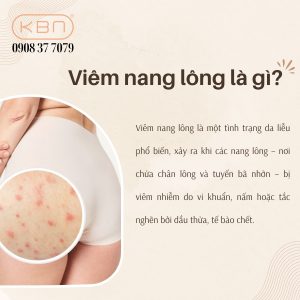 tri-viem-nang-long-bang-nha-dam