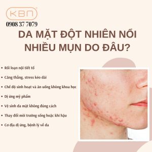 da-mat-dot-nhien-noi-nhieu-mun-do-dau