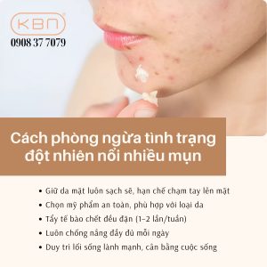 da-mat-dot-nhien-noi-nhieu-mun-mu