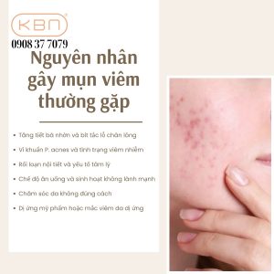 huong-dan-cach-cham-soc-mun-viem