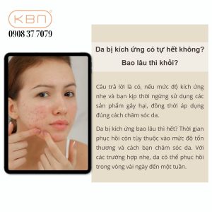 phuc-hoi-da-bi-kich-ung-tai-nha