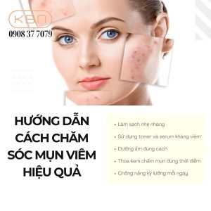 tieu-diet-cac-o-mun-viem
