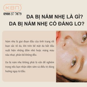 da-bi-nam-nhe