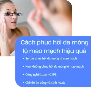 kem-phuc-hoi-da-mong-noi-mach-mau