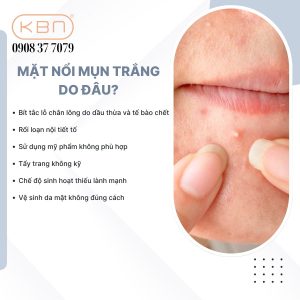 mat-noi-mun-trang-do-dau