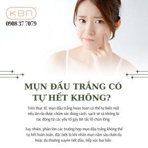 mat-noi-mun-trang-nho-khong-ngua