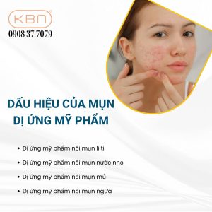 mun-di-ung-my-pham-nhu-the-nao