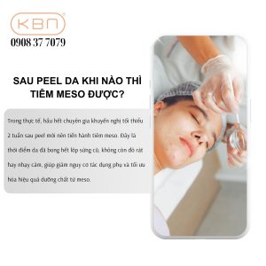 tiem-meso-xong-peel-da-duoc-khong