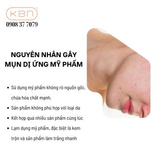 tri-mun-di-ung-my-pham-tai-nha