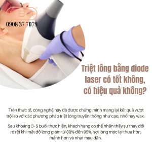triet-long-bang-diode-laser-co-tot-khong