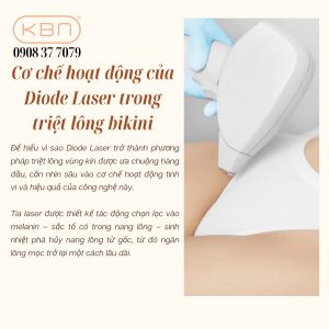 triet-long-vung-kin-bang-laser