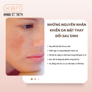 cach-cham-soc-da-mat-sau-sinh