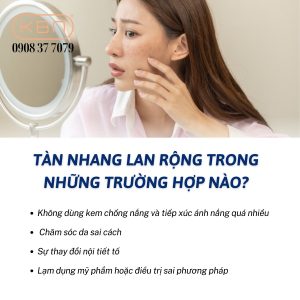 cach-tri-tan-nhang-don-gian-tai-nha
