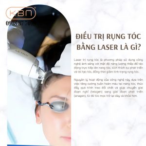 phac-do-dieu-tri-rung-toc