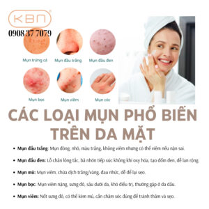 tai-sao-mun-cu-noi-hoai