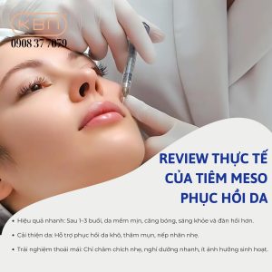 tiem-meso-phuc-hoi-da-nhiem-corticoid