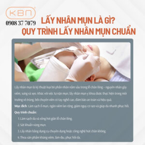 bi-mun-co-nen-di-lay-nhan-mun-khong