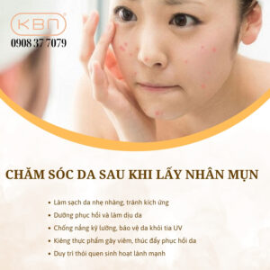 cach-lay-nhan-mun-khong-can-nan