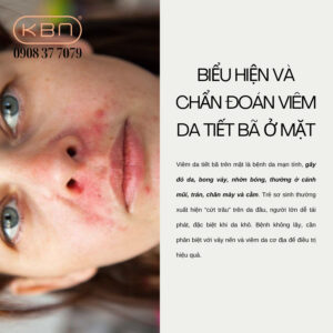 cach-tri-viem-da-tiet-ba-o-mat