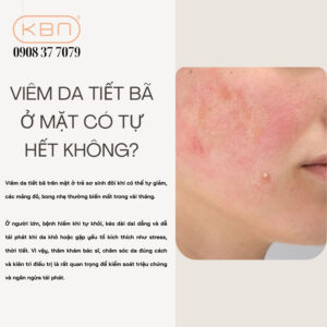 cach-tri-viem-da-tiet-ba-o-mat-tai-nha
