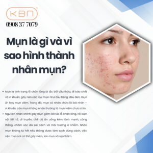 lay-nhan-mun-co-het-mun-khong