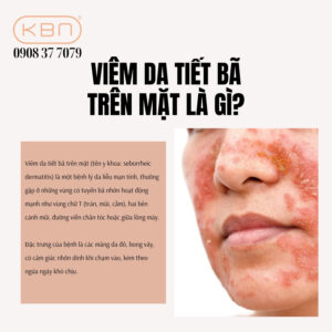 viem-da-tiet-ba-tren-mat