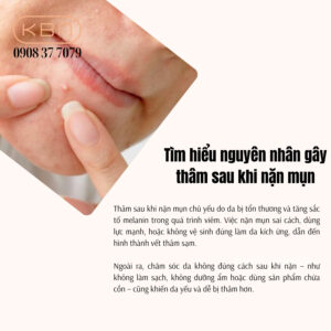 cach-nan-mun-khong-bi-tham