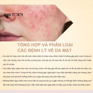 hinh-anh-cac-benh-ve-da-lieu