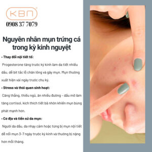 lam-sao-de-khong-bi-mun-khi-den-thang