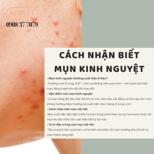 mun-kinh-nguyet-nhu-the-nao