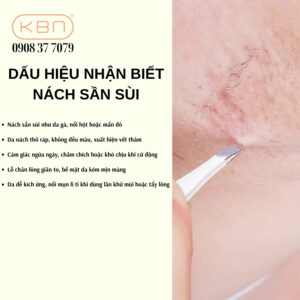 nach-san-sui-nhu-da-ga