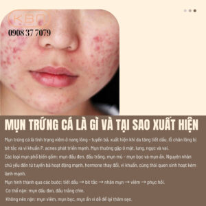 nan-mun-trung-ca-dung-cach