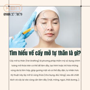 nen-cay-mo-tu-than-hay-tiem-filler