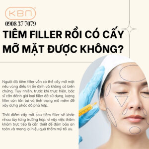 tiem-filler-roi-co-cay-mo-mat-duoc-khong