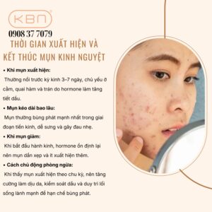 vi-sao-den-thang-lai-noi-mun