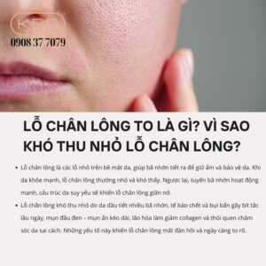 lo-chan-long-to-co-nen-peel-da-khong