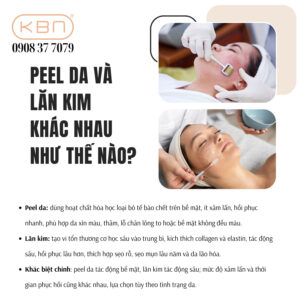 nen-lan-kim-hay-peel-da