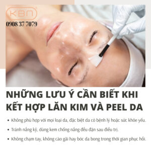 peel-da-ket-hop-phi-kim