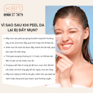 peel-da-xong-bao-lau-thi-nan-mun