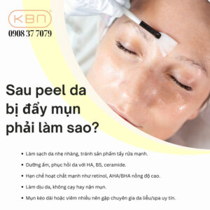 sau-peel-da-bi-day-mun-phai-lam-sao
