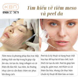 tiem-meso-xong-peel-da-duoc-khong