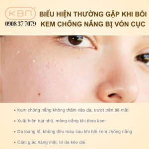 boi-kem-chong-nang-bi-von-cuc