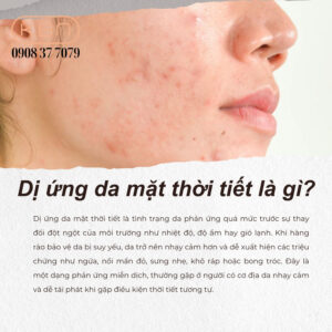 di-ung-da-mat-thoi-tiet