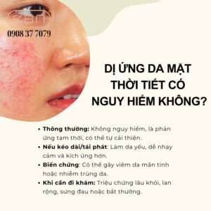 meo-chua-di-ung-thoi-tiet-tai-nha