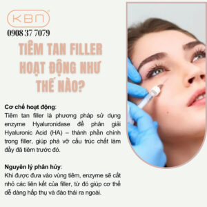 tiem-filler-khong-tiem-tan-co-sao-khong