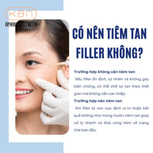 tiem-tan-filler-co-tan-lien-khong