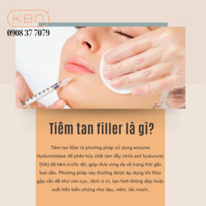tiem-tan-filler-kieng-an-gi